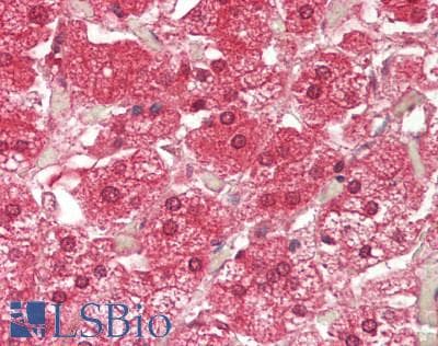 Polyclonal Rabbit anti-Human ATE1 Antibody (aa432-481, IHC, WB)