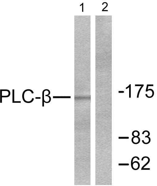 Polyclonal Rabbit anti-Human PLCB3 Antibody (p1105, IHC, WB)