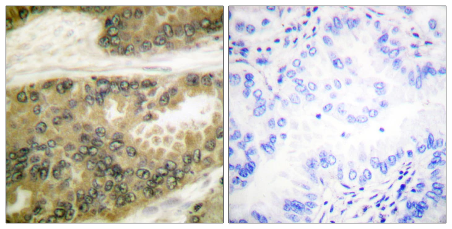 CCND3 / Cyclin D3 Antibody (aa243-292)