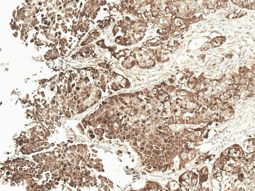 VDAC1 / PORIN Antibody