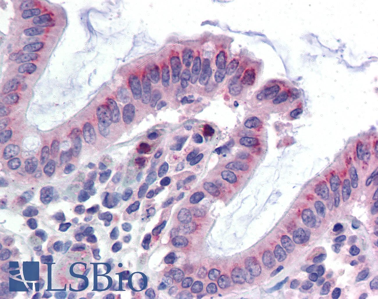 IHC-plus™ Polyclonal Rabbit anti-Human GCNT3 Antibody (Internal)
