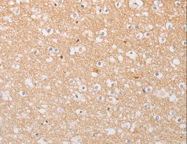 Polyclonal Rabbit anti-Human ATG9A Antibody (IHC, WB)