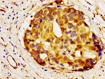 A1BG Antibody