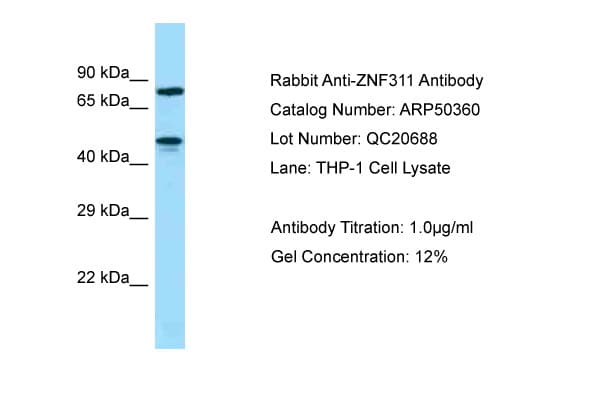 ZNF311 Antibody (aa187-236)