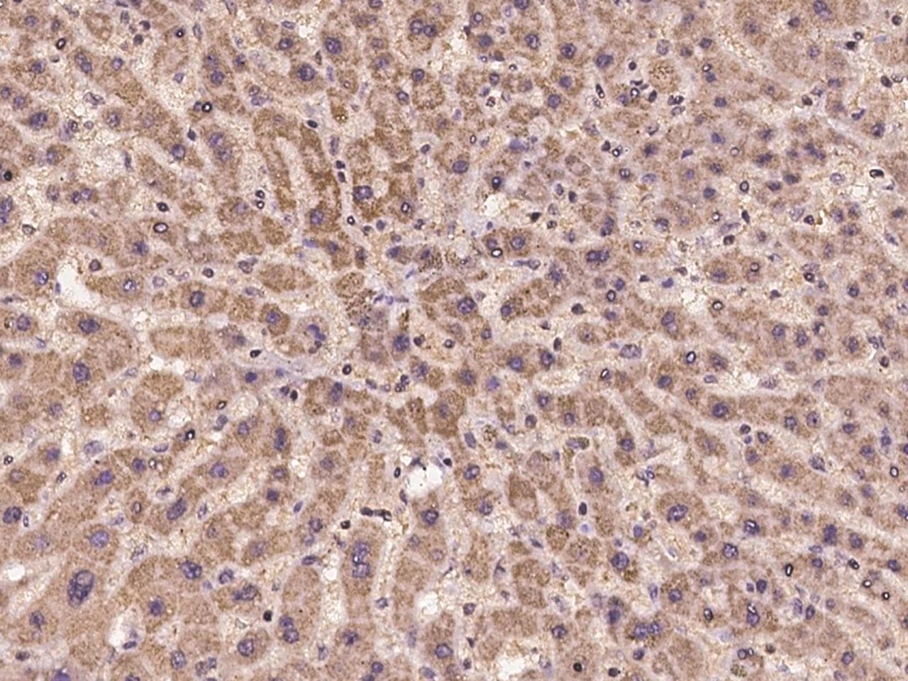 Polyclonal Rabbit anti-Human CHMP2A Antibody (IHC)