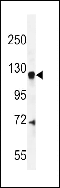 AGAP2 / PIKE Antibody (aa850-877)