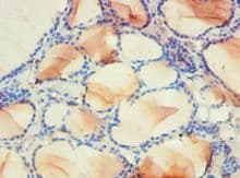 Polyclonal Rabbit anti-Human PDPK1 / PDK1 Antibody (aa277-556, IHC, WB)