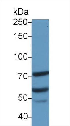 MTA2 Antibody (aa1-394)