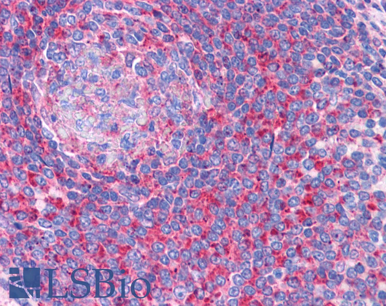 IHC-plus™ Polyclonal Goat anti-Human TPD52L2 / HD54 Antibody (aa195-205, IHC, WB)