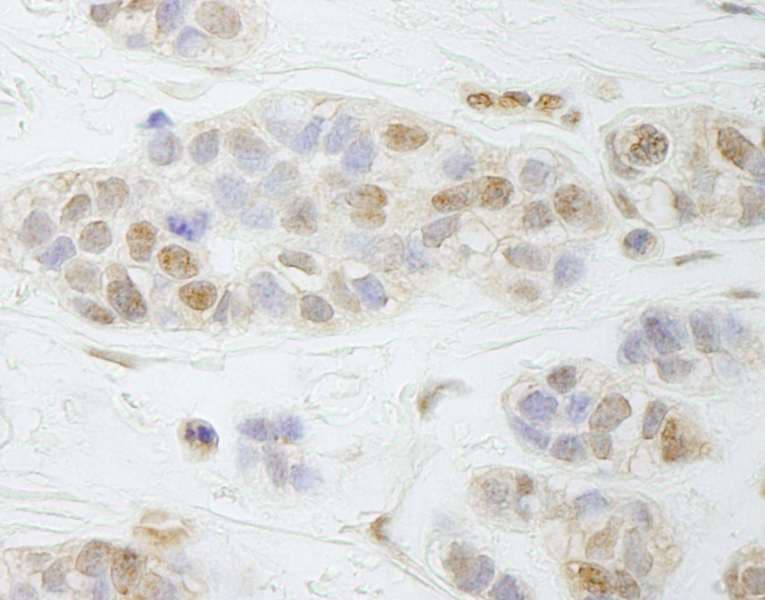 PALB2 Antibody (aa200-250)