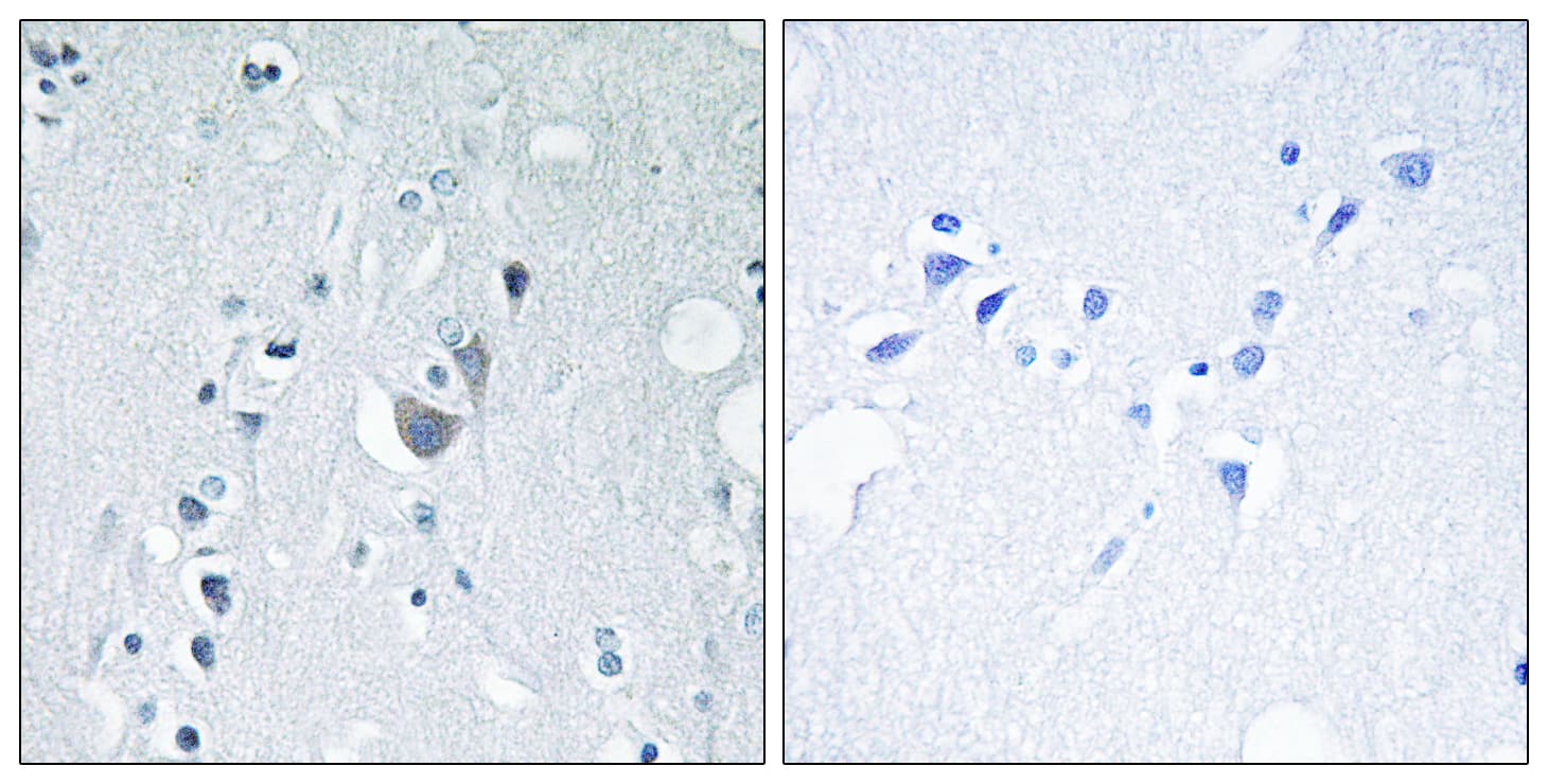 Polyclonal Rabbit anti-Human SAPK / JNK / MAPK8 + MAPK9 + MAPK10 Antibody (phospho-Tyr185, IHC, WB)