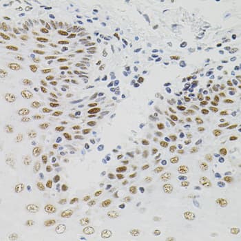 Polyclonal Rabbit anti-Human AKAP8 / AKAP95 Antibody (AP, IHC, WB)