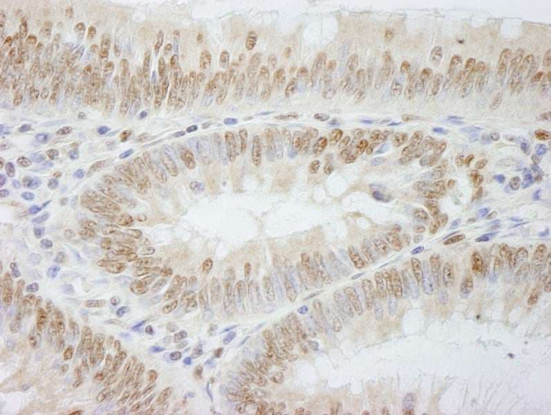 Polyclonal Rabbit anti-Human POLE3 / DNA Polymerase Epsilon Antibody (aa97-147, IHC)