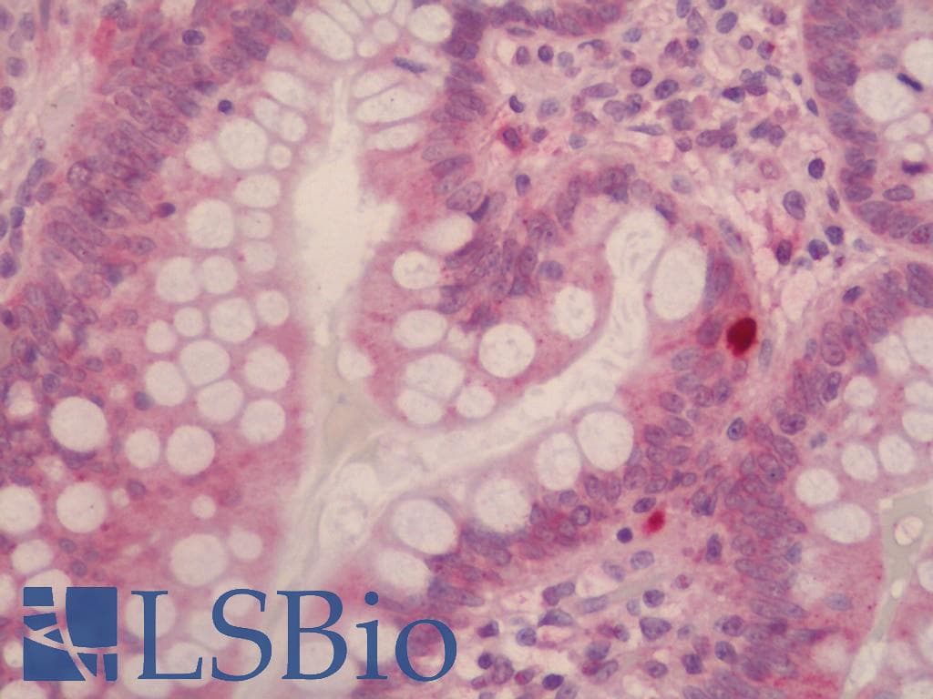 IHC-plus™ SCN2A / Nav1.2 Antibody (aa983-1032)