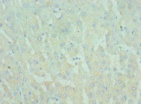 TIRAP Antibody (aa1-221)