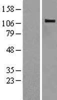 CBLB Protein (Over-Expression Lysate Myc-DDK (Flag))