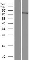 FAM200B Protein (Over-Expression Lysate Myc-DDK (Flag))