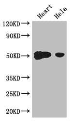 Polyclonal Rabbit anti-Human TFDP2 / DP2 Antibody (IHC, WB)