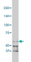Monoclonal Mouse anti-Human PAK1 Antibody (clone 4D1, IF, WB)