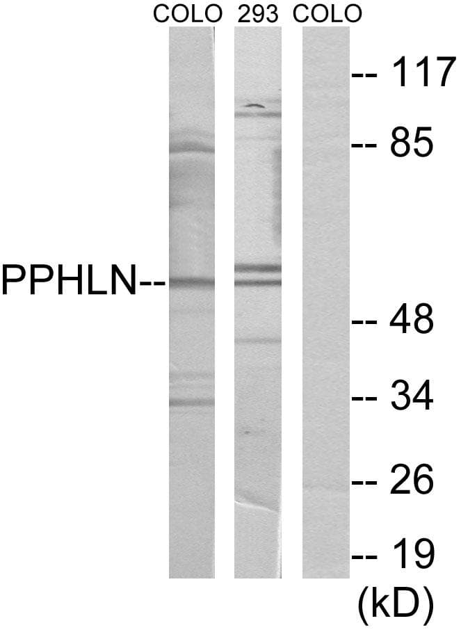 PPHLN1 Antibody
