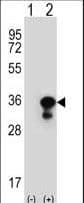 Polyclonal Rabbit anti-Human PCNA Antibody (aa231-261, IHC, IF, WB)