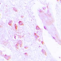 ABHD12B Antibody (C-Terminus)