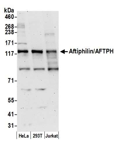 AFTPH Antibody (aa575-625)