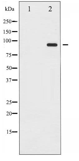 Polyclonal Rabbit anti-Human PR / Progesterone Receptor Antibody (phospho-Ser294, IF, WB)