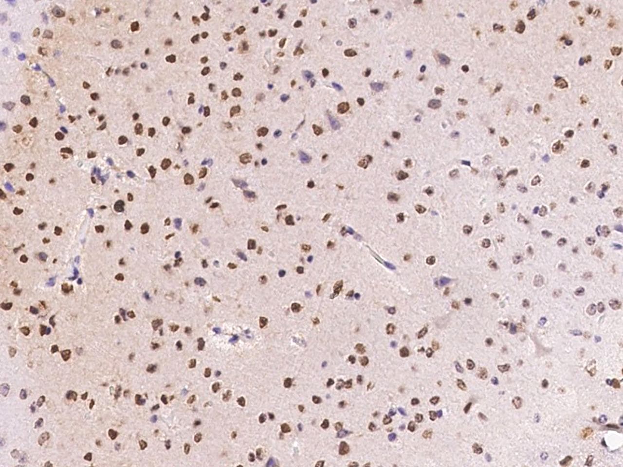 RYK Antibody (Preservative Free)