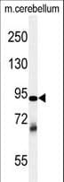 ZRANB1 / TRABID Antibody (aa665-692)