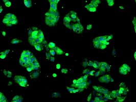 SORD / Sorbitol Dehydrogenase Antibody (clone OTI1D5)
