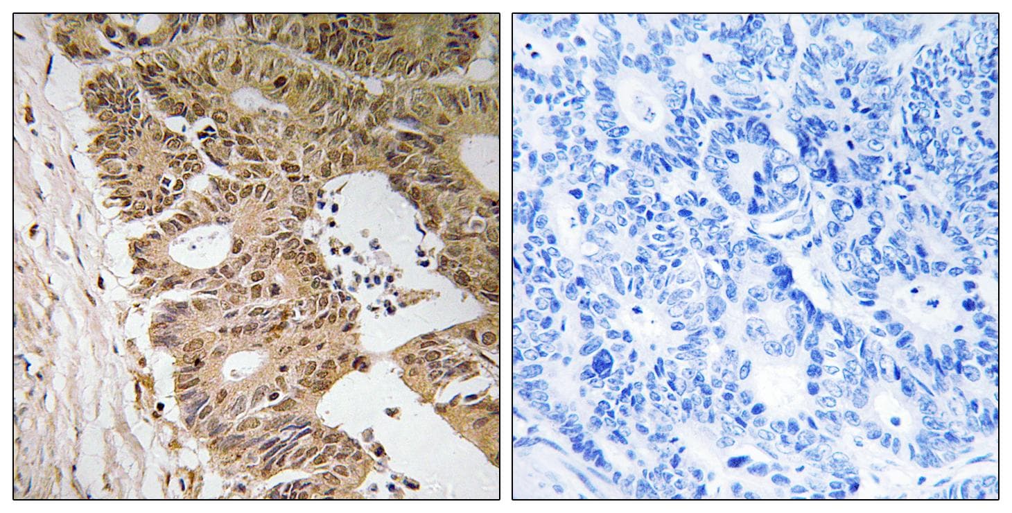 Polyclonal Rabbit anti-Human ZC3H8 Antibody (IHC, WB)
