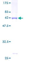 Human ANXA8 / Annexin A8 Protein (Recombinant GST)