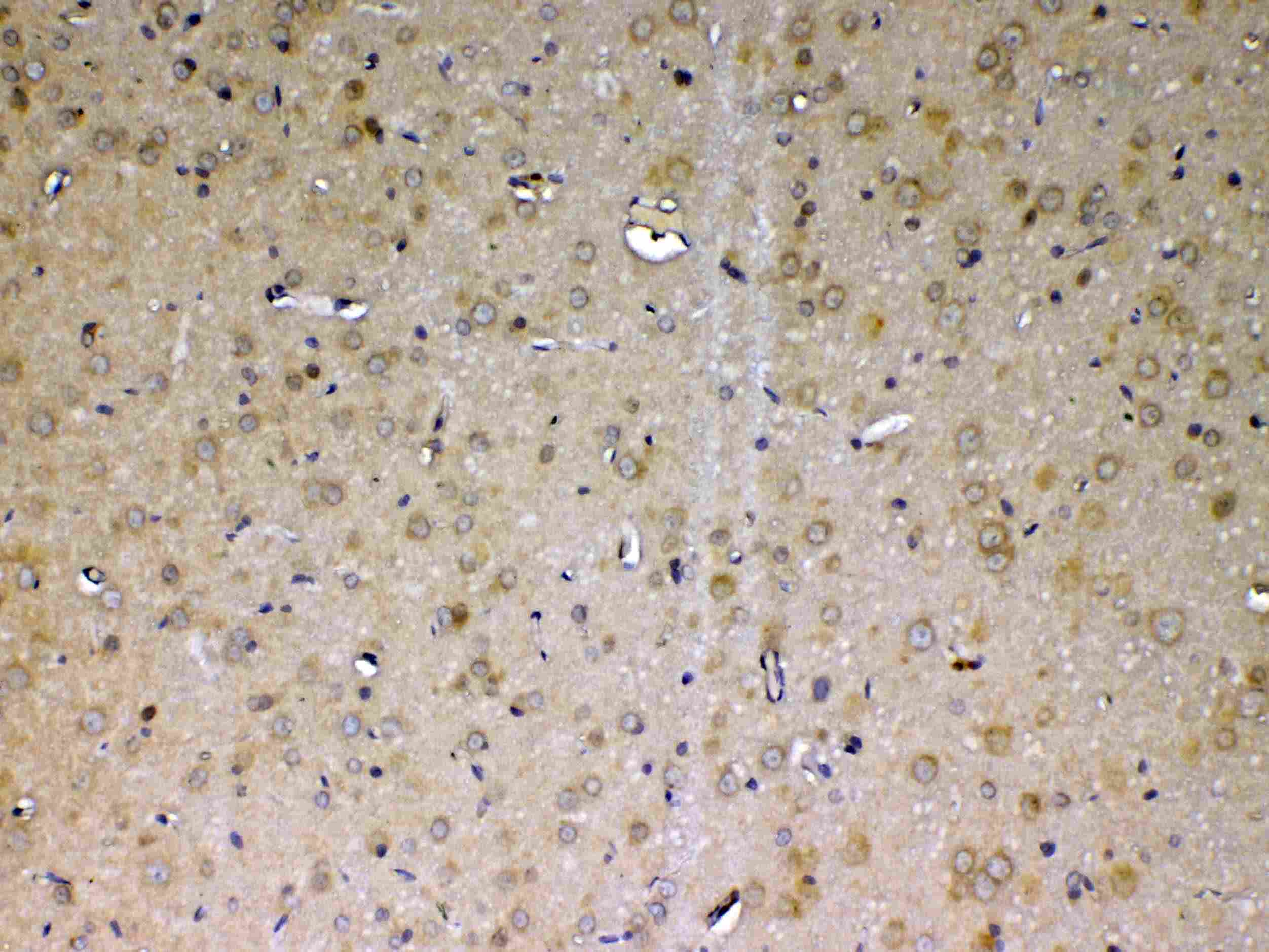 ADA / Adenosine Deaminase Antibody