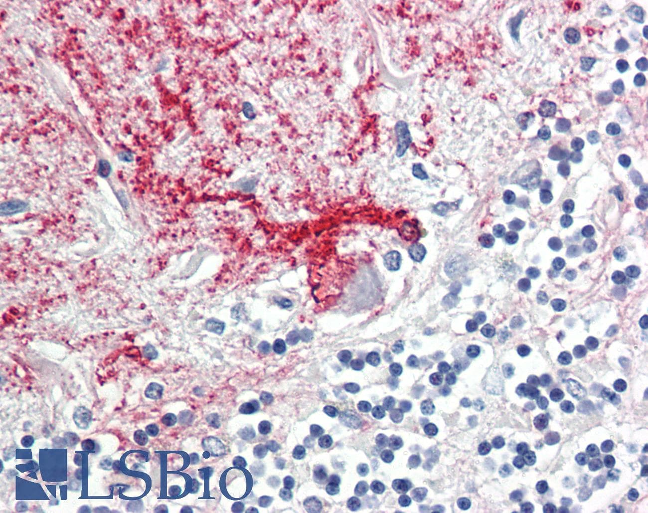 IHC-plus™ DAB1 Antibody (aa189-216)
