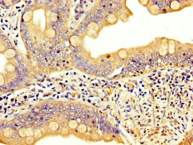 LIM Protein / LPP Antibody