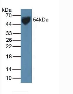 SLC2A1 / GLUT-1 Antibody (aa251-329)