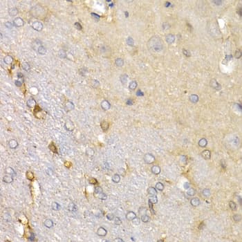 Polyclonal Rabbit anti-Human SFRP2 Antibody (IHC, IF, WB)