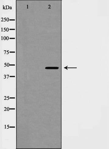 Polyclonal Rabbit anti-Human CCNE2 / Cyclin E2 Antibody (IHC, IF, WB)