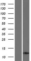 CARD17 / INCA Protein (Over-Expression Lysate Myc-DDK (Flag))