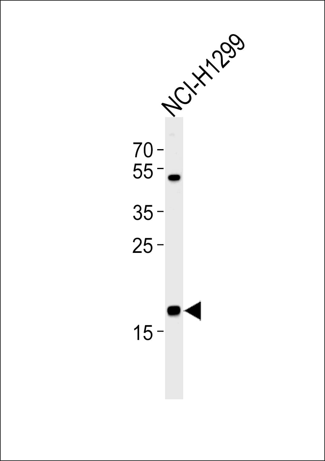 CFL2 / Cofilin 2 Antibody (aa25-54)
