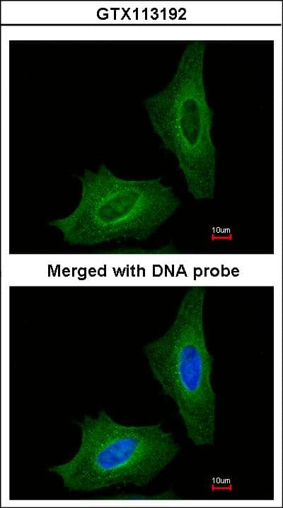 GAD65 Antibody