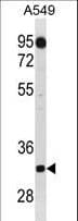 C1QTNF2 / CTRP2 Antibody (aa257-285)