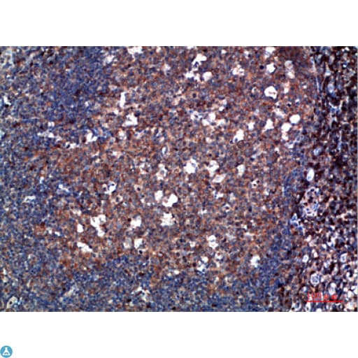 TPSD1 / Tryptase Delta 1 Antibody
