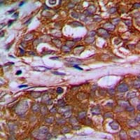 MRPL22 Antibody (Internal)