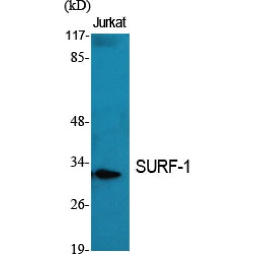 Polyclonal Rabbit anti-Human SURF1 Antibody (140-220 aa, Internal, IHC, IF, WB)
