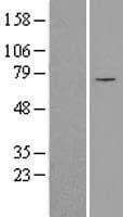 SLC25A12 / ARALAR Protein (Over-Expression Lysate Myc-DDK (Flag))