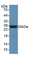 Leptin Antibody (aa22-167)