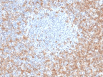 CD5 Antibody (clone CD5/2416)