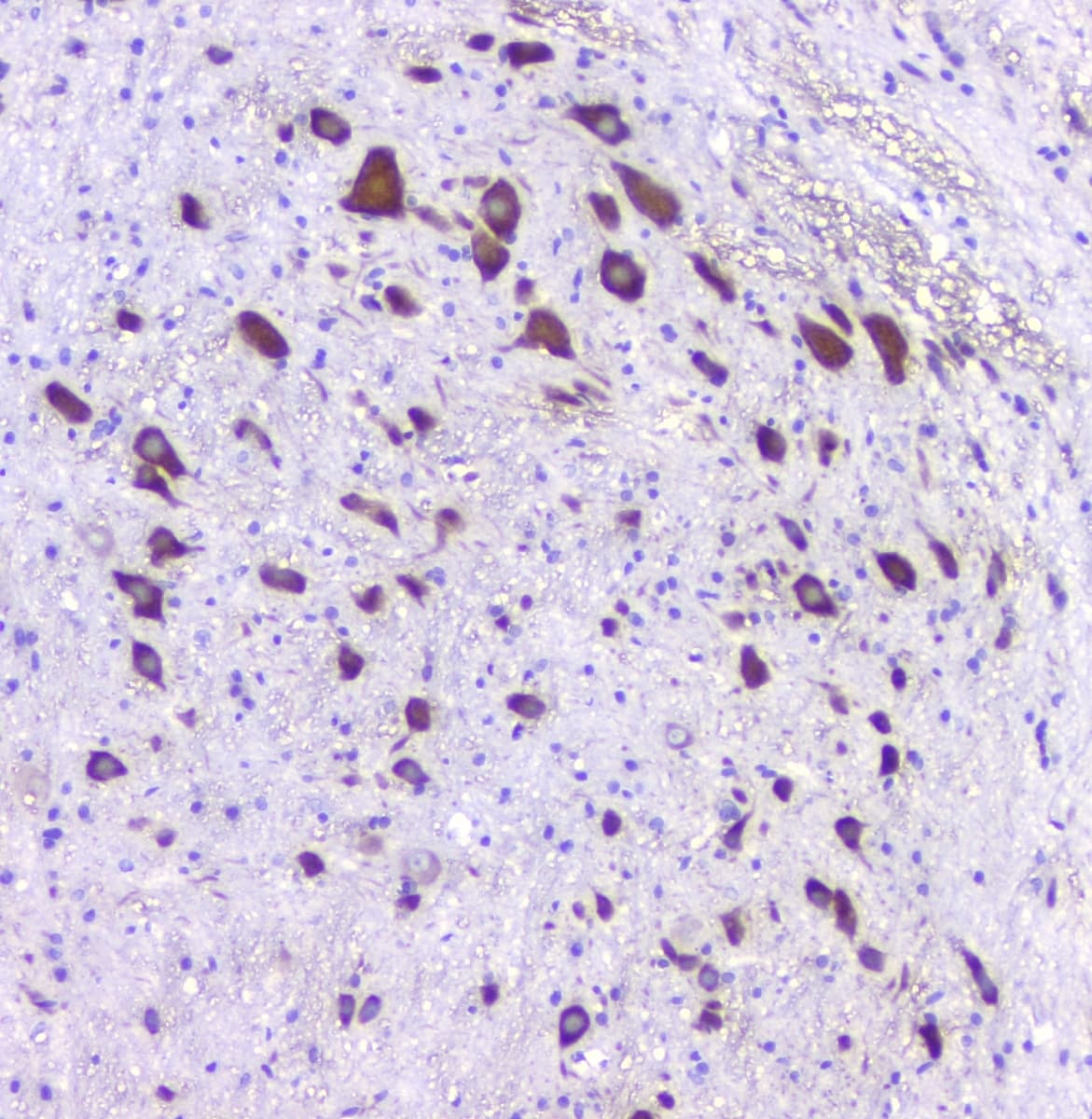 HTR2A / 5-HT2A Receptor Antibody (aa400-431)